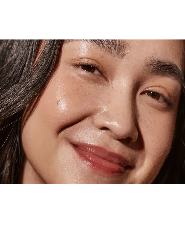 All About Acne and Blemish Prone Skin