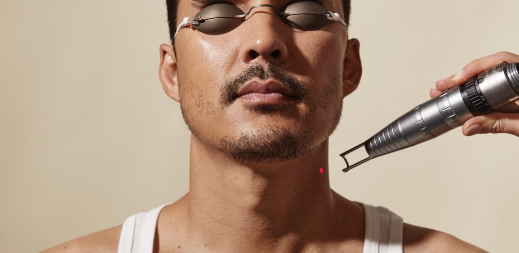 A man with protective eye shields and a white tank top receiving a laser treatment on his neck, with a red laser light visible on his skin, emphasizing a professional skincare procedure for men.